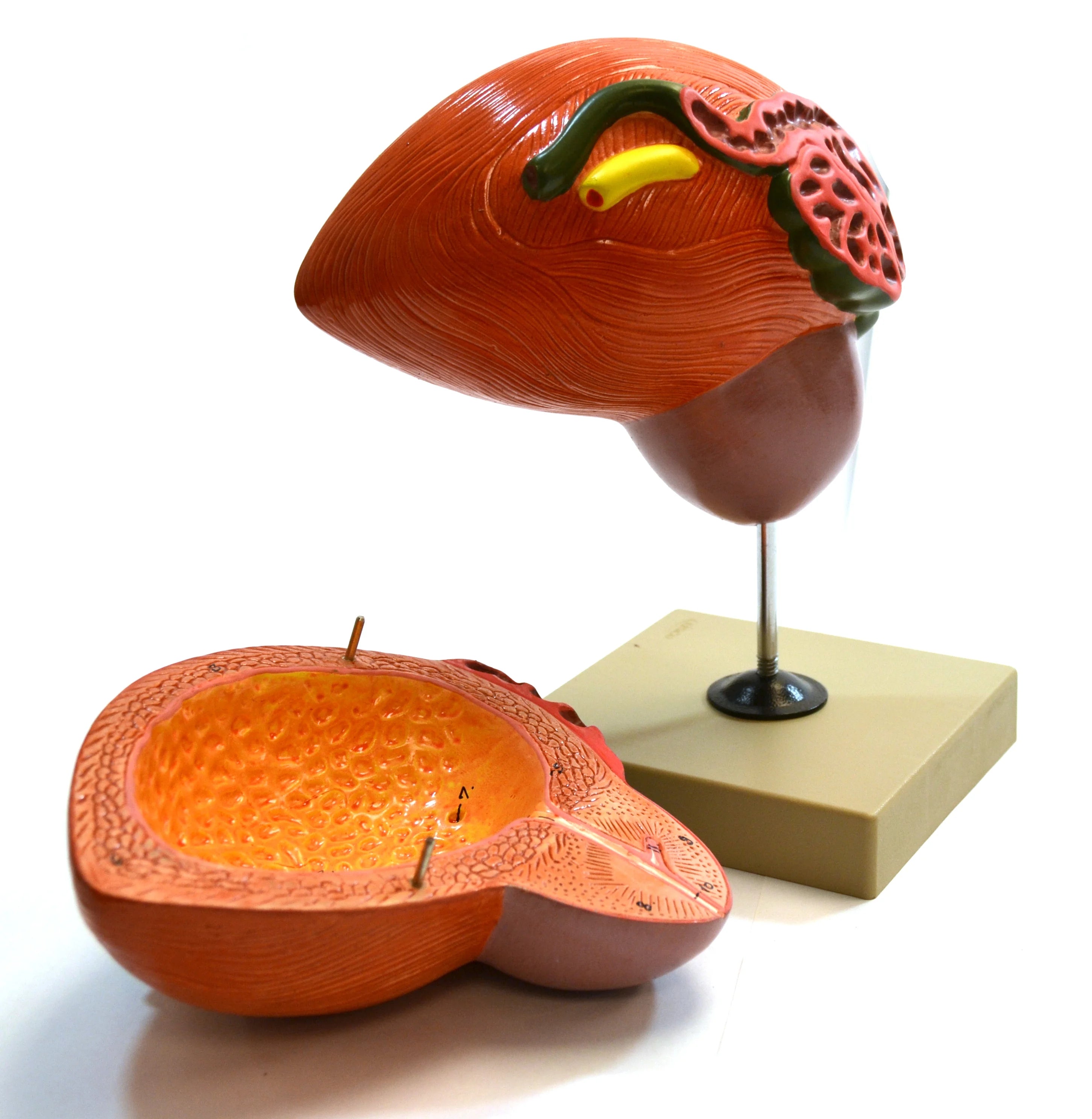 Human Urinary Bladder with Prostate Anatomical Model, 2 Parts, 3 Times Life Size B776391
