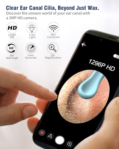 Ear Wax Removal Camera, 1296P HD, 8pcs Ear Set, Wireless WiFi Otoscope, 6 Lights, Rechargeable Earwax Removal Tool Kit (Black) I45507