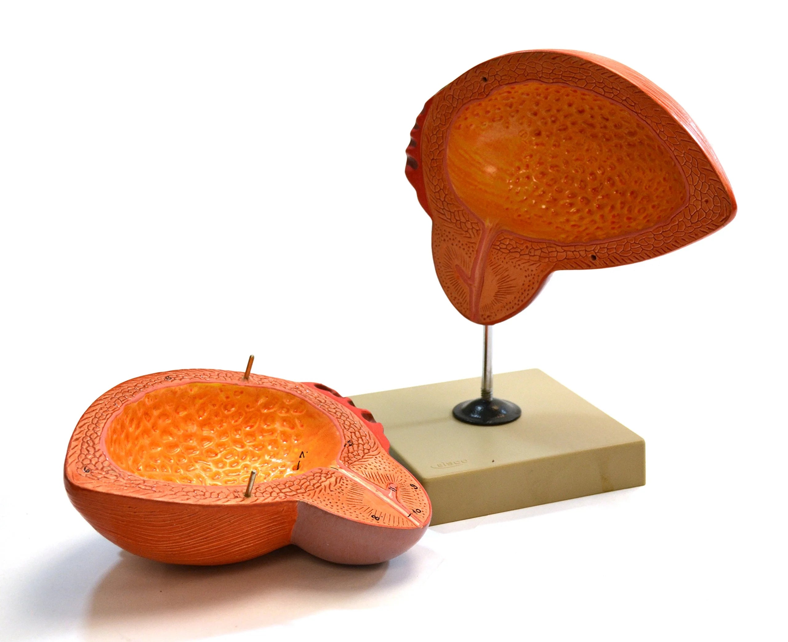Human Urinary Bladder with Prostate Anatomical Model, 2 Parts, 3 Times Life Size B776391